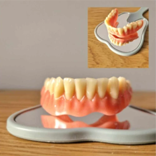 Création d'une prothèse dentaire